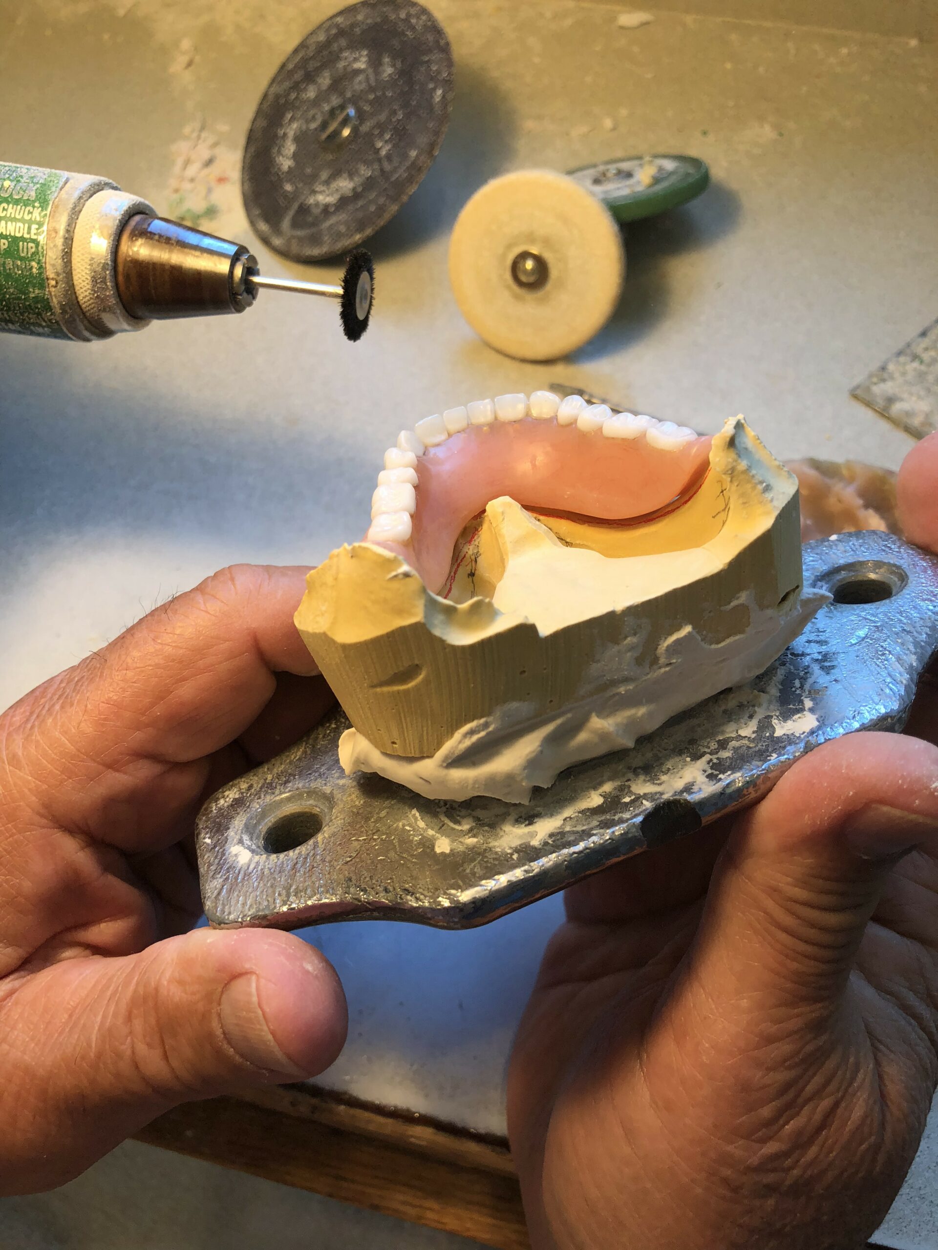 What You Need To Know To Get A Great Denture Reline