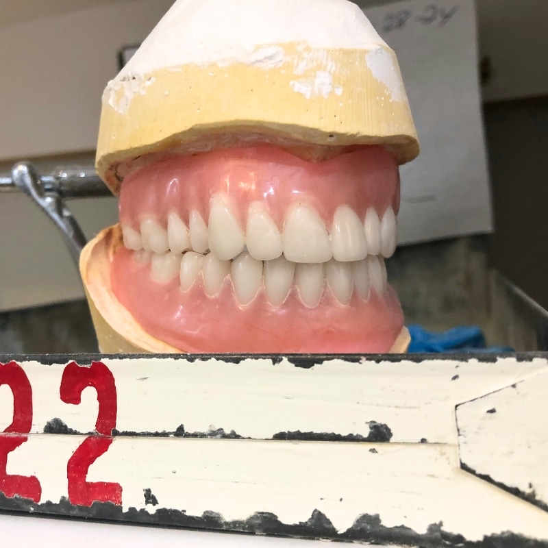 Upper and lower denture sitting in tray