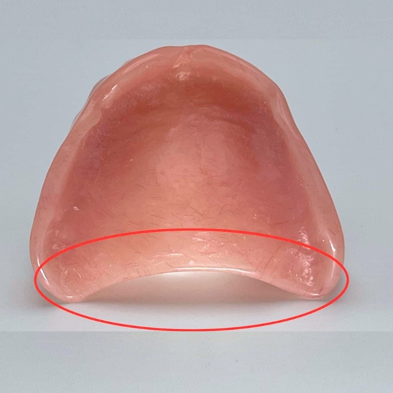upper denture from top, back is cut wrong, always loose