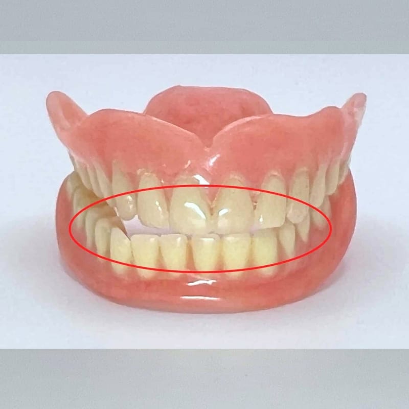 upper and lower with bite off. Will not work properly