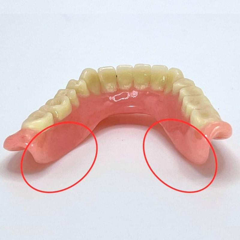 denture from back showing short sublingual area