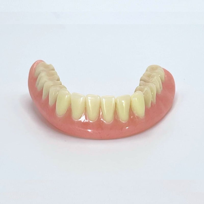 Bad impression that doesn't follow mouth anatomy