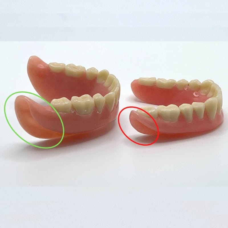 picture show a denture short in the sublingual area and one that is not